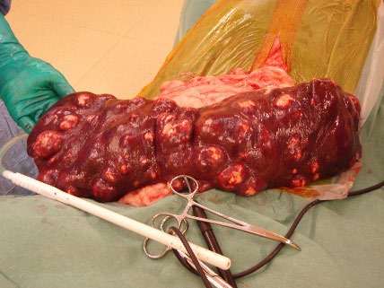 Cytologi av lymfom hos hund